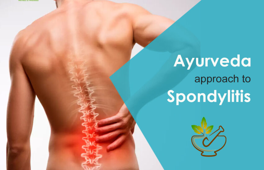 ayurveda approach to Spondylitis