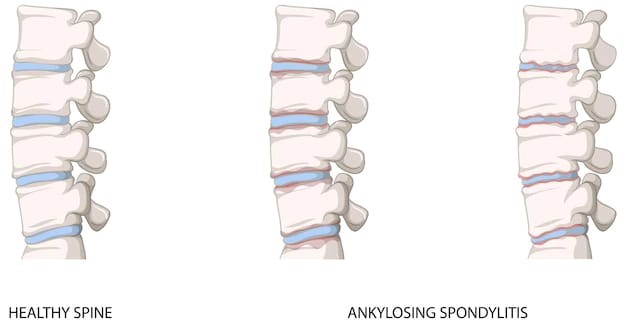 Healthy Spine