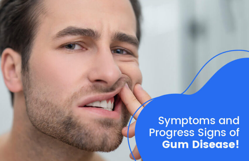 symptoms-of-gum-disease