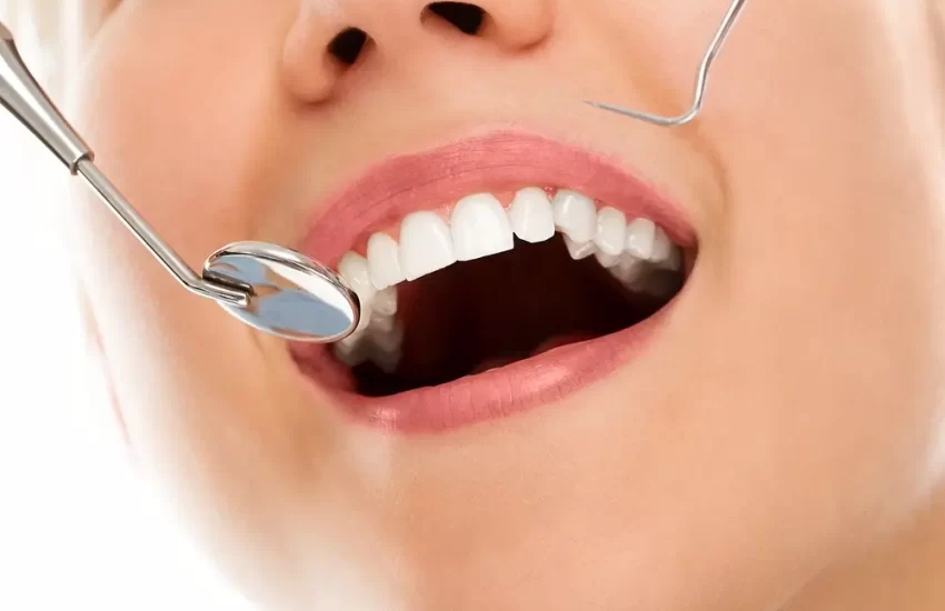 teeth-whitening