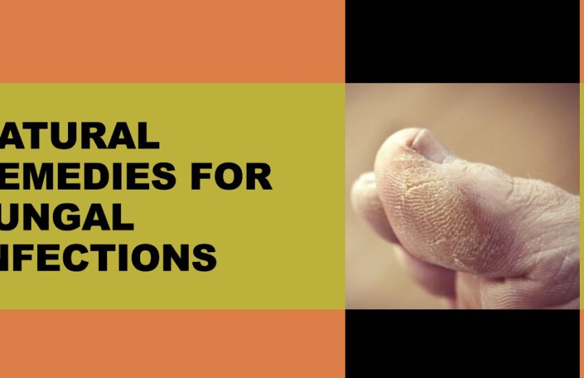 Natural Remedies for Fungal Infections
